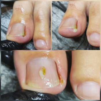 Ярослава Кречмаровська, Нетішин Фото - 16