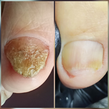 Ярослава Кречмаровська, Нетішин Фото - 17