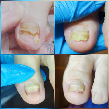 Ярослава Кречмаровська, Нетішин Фото - 18