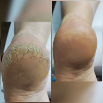 Ярослава Кречмаровська, Нетішин Фото - 19