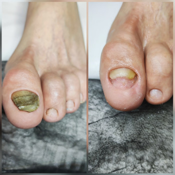 Ярослава Кречмаровська, Нетішин Фото - 23