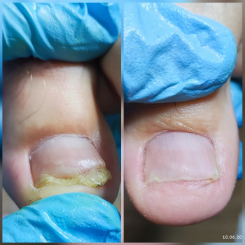 Ярослава Кречмаровська, Нетішин Фото - 24