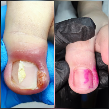 Ярослава Кречмаровська, Нетішин Фото - 25