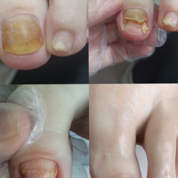 Ярослава Кречмаровська, Нетішин Фото - 27