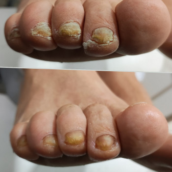 Ярослава Кречмаровська, Нетішин Фото - 29