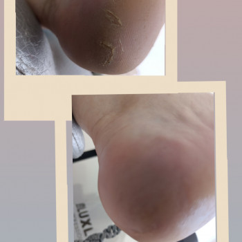 Ярослава Кречмаровська, Нетішин Фото - 30