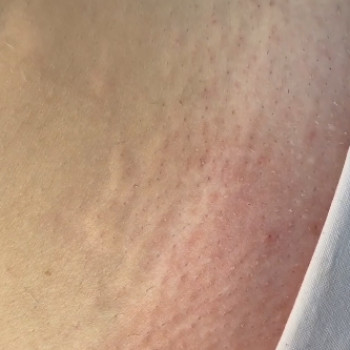 Lazer Shelk, Шостка Фото - 5