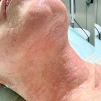 Христина Бедунова, Шостка Фото - 5