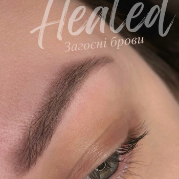 Загоєні брови   