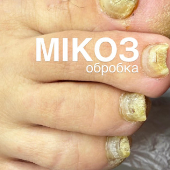 Ольга Гребеник, Конотоп Фото - 5