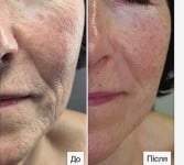 Догляд обличчя, з миттєвим результатом Массажист Мария Киев