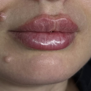 Ксенія Рубльова, Ужгород Фото - 4