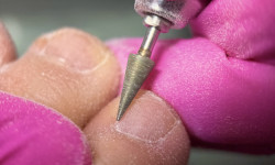 Медичний педикюр Подолог Алина Мукачево