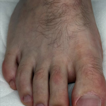 Фото из портфолио клиники Aura (центры подологии, Запорожье)