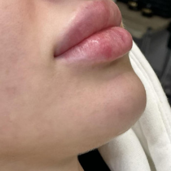 Estet Clinic, Запорожье Фото - 2