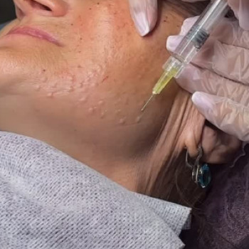 Estet Clinic, Запорожье Фото - 3