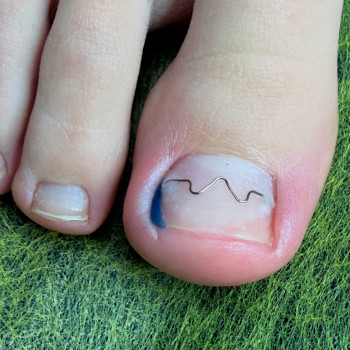 Алена Мазур, Винница Фото - 1