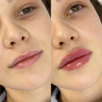 Тетяна Ніконенко, Запоріжжя Фото - 1