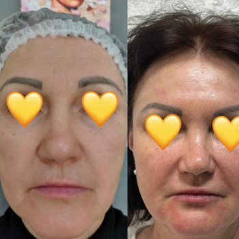 Ксенія Цибанова, Запоріжжя Фото - 5