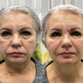 Виктория , Запорожье Фото - 5