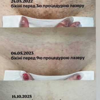 Фото из портфолио салона Comfort Epil (косметологический центр, Запорожье)