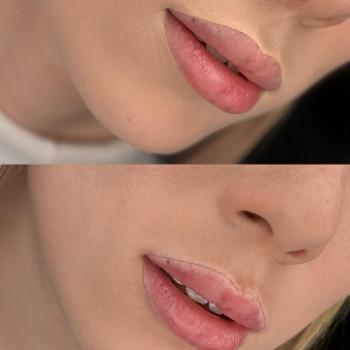 Лилия Логвиненко, Запорожье Фото - 5