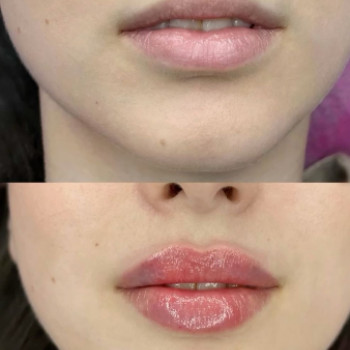 Kovalik Beauty, Запоріжжя Фото - 4