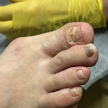 Фото з портфоліо фахівця Олена Шибанова (подолог, Черкаси)