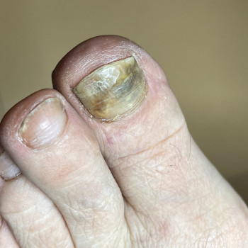 Фото з портфоліо фахівця Олена Шибанова (подолог, Черкаси)