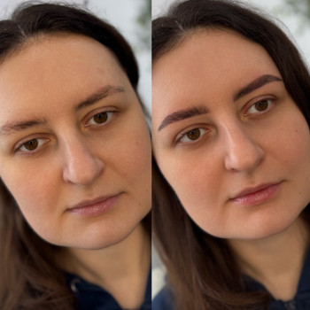 Моделювання та корекція брів
На 3-4 тижні за 20-25 хв