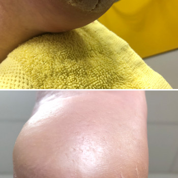 Ірина Абраменко, Кременчуг Фото - 11