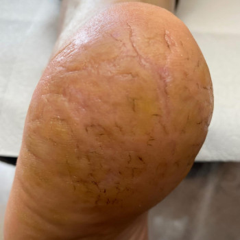 Выезд на дом
                    Подолог Ольга Чернигов