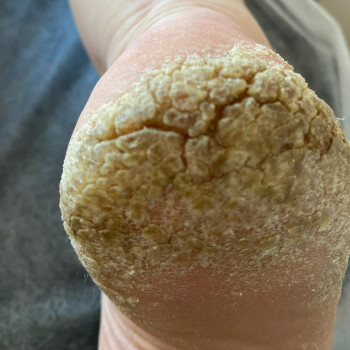 Выезд на дом
                    Подолог Ольга Чернигов