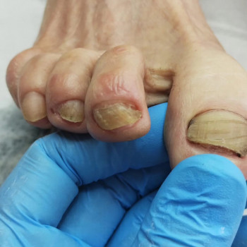 Выезд на дом
                    Подолог Ольга Чернигов