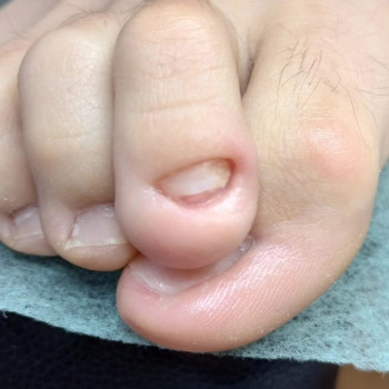 Выезд на дом
                    Подолог Ольга Чернигов