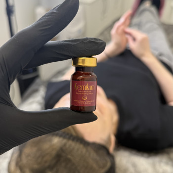 Біоревіталізуючий пілінг кемікум