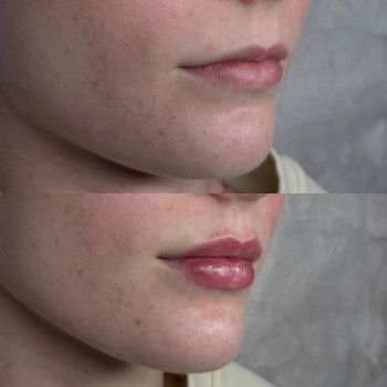 Ксенія Рубльова, Ужгород Фото - 1