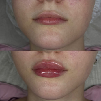 Ксенія Рубльова, Ужгород Фото - 3