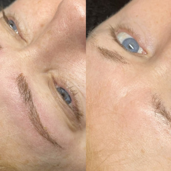 Мікроволосок