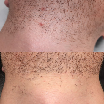 Ася Коок, Одесса Фото - 5