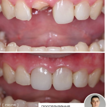 MKeramika, Запорожье Фото - 3