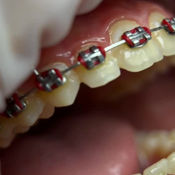 Romanov Dental, Запорожье Фото - 5