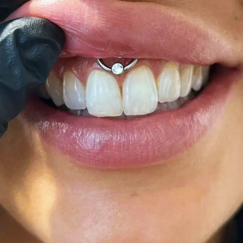 Пірсинг смайл
   