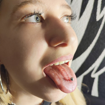 Пірсинг язика
   