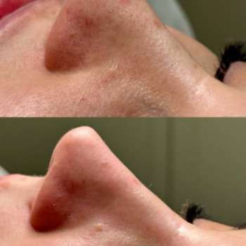 Анастасія Науменко, Київ Фото - 5