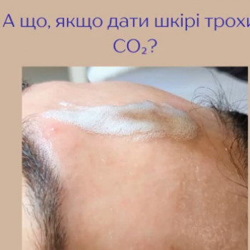 Екатерина Осадчук, Киев Фото - 5