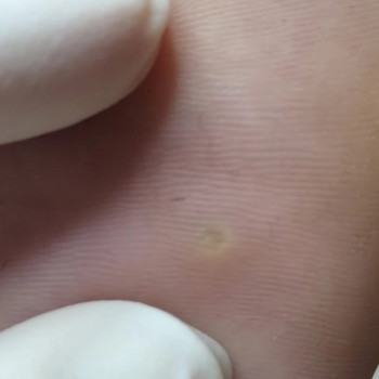 Ольга Живець, Чернігів Фото - 19