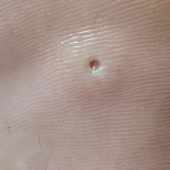 Ольга Живець, Чернігів Фото - 20