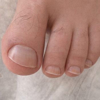 Чоловічий педикюр — це важливий етап підтримки здоров’я стоп та профілактики можливих захворювань.