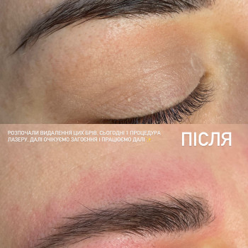 Олена Левурдяк, Бориспіль Фото - 11